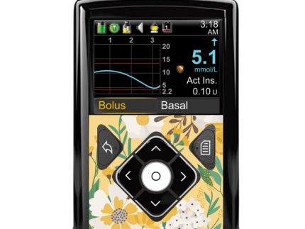 Medtronic 640G/670G/780G Button Panel Sticker (Summer Fields)