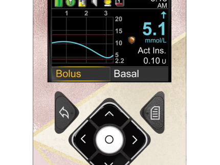 Medtronic 640/670/780G Pump Sticker (Blush Geo)