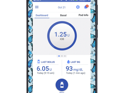 Omnipod DASH Cover (Butterfly Blue)