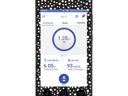 Omnipod DASH Cover (Black Spotty Dotty)