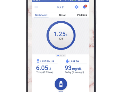 Omnipod DASH Cover (Marble Dreams)
